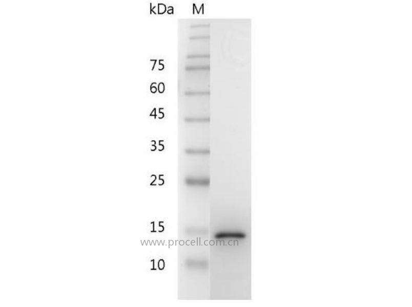 GDNF/ATF/HSCR3, Mouse, Recombinant