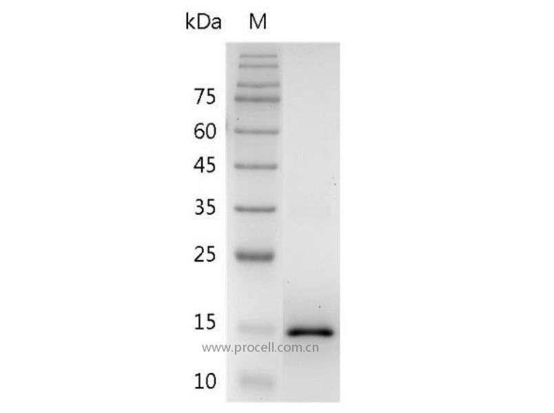 IL-17F/C87042, Mouse, Recombinant