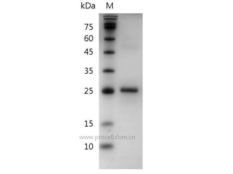 IL-34/2010004A03Rik, Il34, Mouse, Recombinant