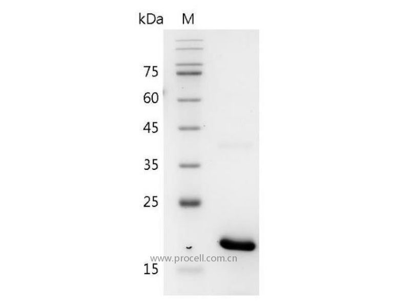 IL-17B/Zcyto, Mouse, Recombinant