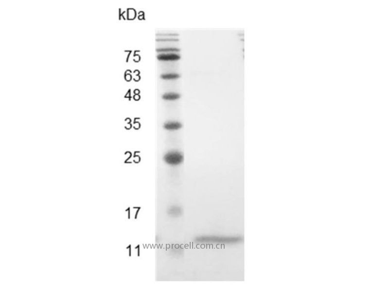 CCL4/MIP-1β/ACT-2, Mouse, Recombinant