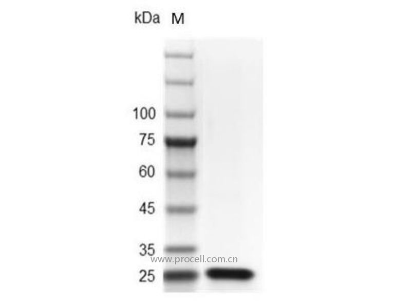 FGF-21/FGFL, Mouse, Recombinant