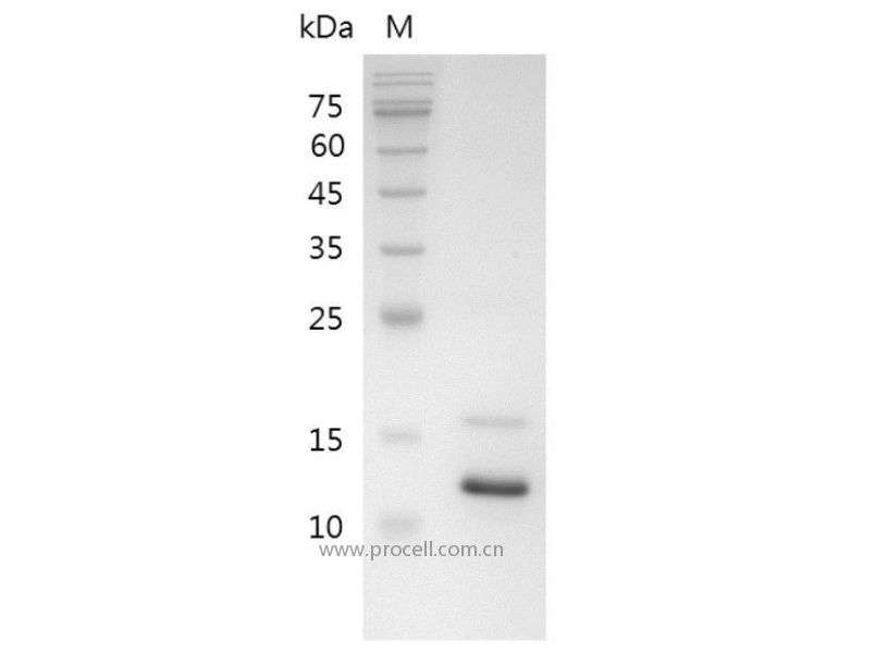 TNF-α/TNFA/TNFSF2, Swine, Recombinant