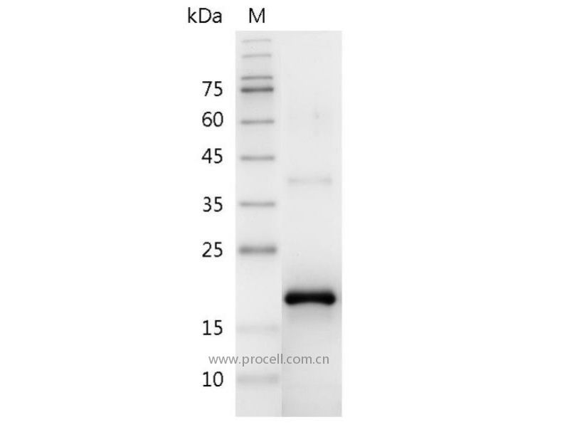 FGF-2/bFGF/FGF-basic, Swine, Recombinant