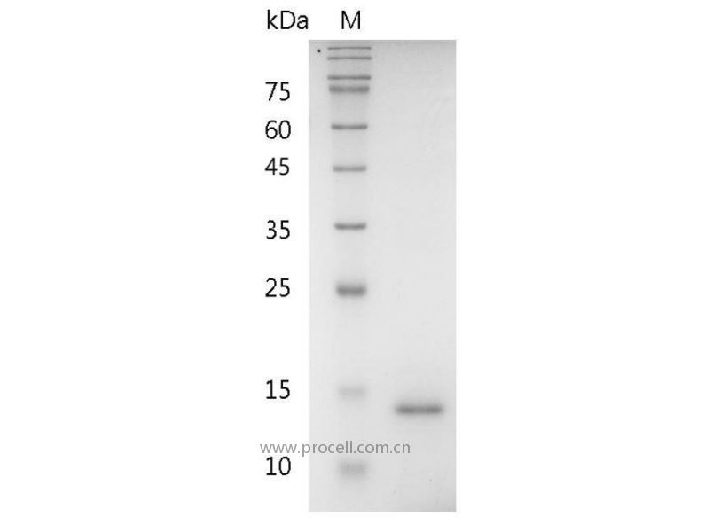 IL-9/HP40, Human, Recombinant