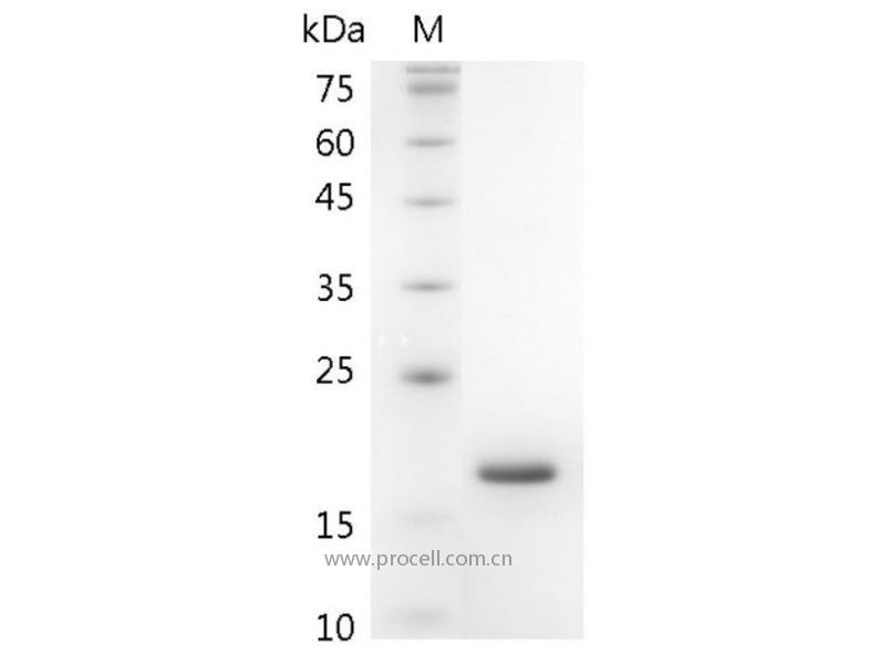 GM-CSF/CSF2, Swine, Recombinant