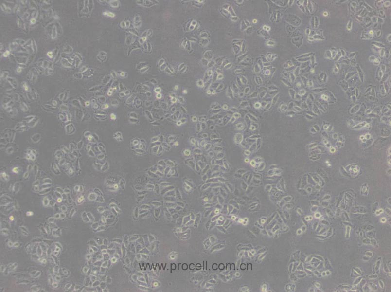 Acc-2 (人涎腺腺樣囊性癌細胞) (Hela污染細胞系，暫不供應)