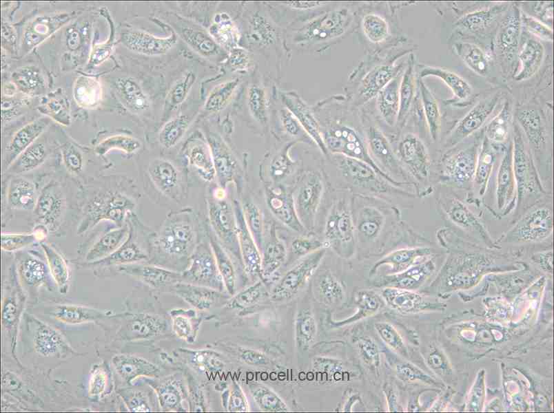 Caki-1 (人腎透明細胞癌皮膚轉移細胞) (STR鑒定正確)