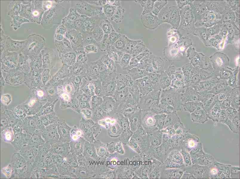 Caov-3 (人乳突狀卵巢腺癌細胞) (STR鑒定正確)