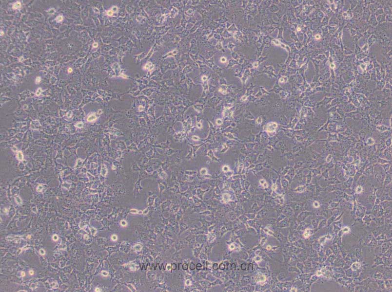 COS-7 (非洲綠猴SV40轉(zhuǎn)化的腎細(xì)胞)