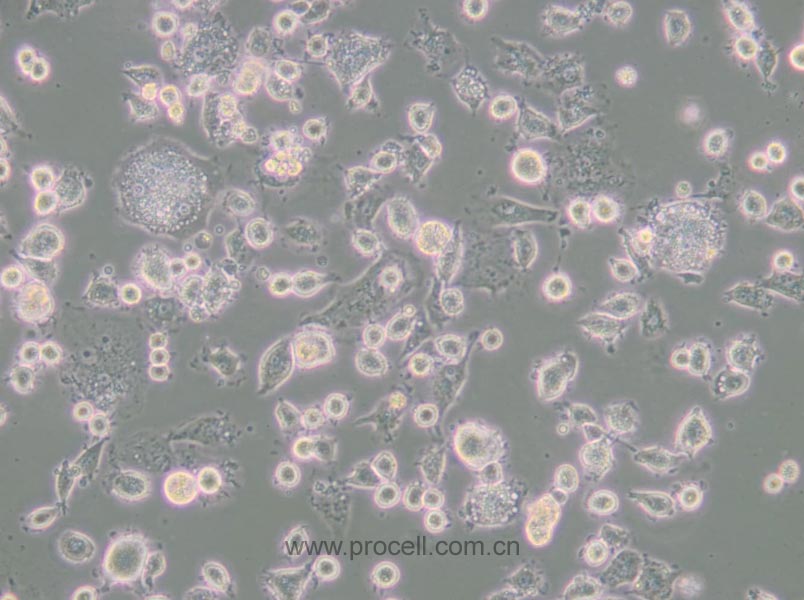 DH82 (犬巨噬細胞/狗腎惡性組織細胞增生癥細胞)(種屬鑒定正確)