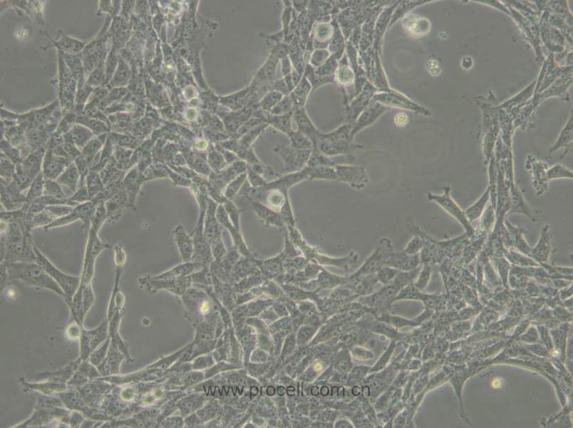 HBL-100 (人整合SV40基因的乳腺上皮細(xì)胞) (STR鑒定正確)