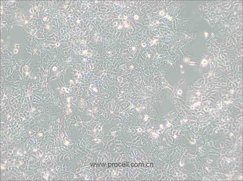 HCC827 (人非小細胞肺癌細胞) (STR鑒定正確)