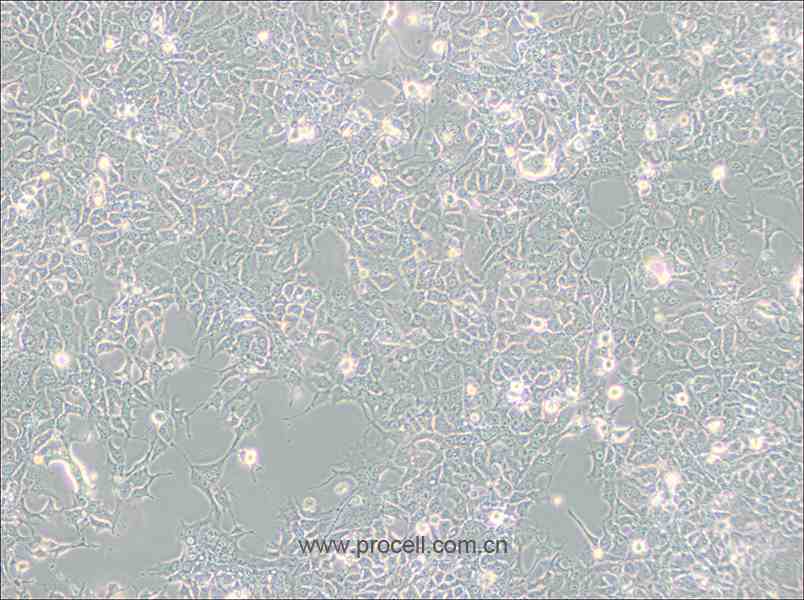 HCC827 (人非小細胞肺癌細胞) (STR鑒定正確)