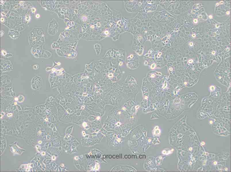 HEC-1-A (人子宮內膜腺癌細胞) (STR鑒定正確)