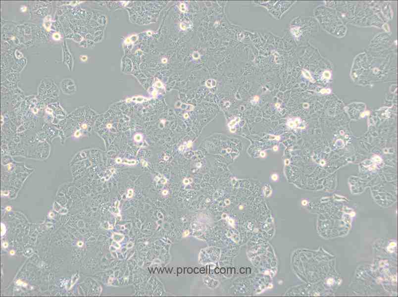 HEC-1-A (人子宮內膜腺癌細胞) (STR鑒定正確)