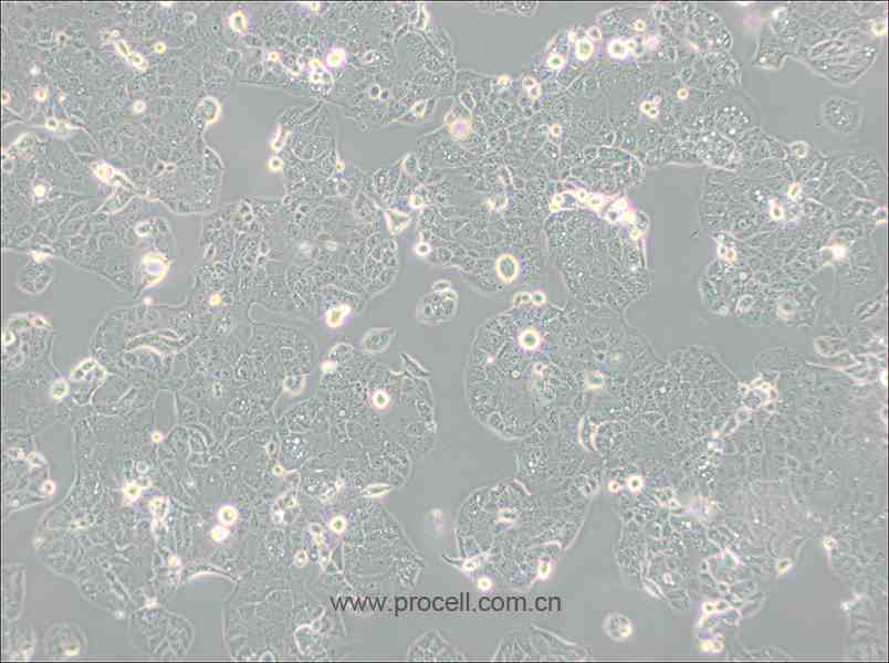 HEC-1-A (人子宮內膜腺癌細胞) (STR鑒定正確)