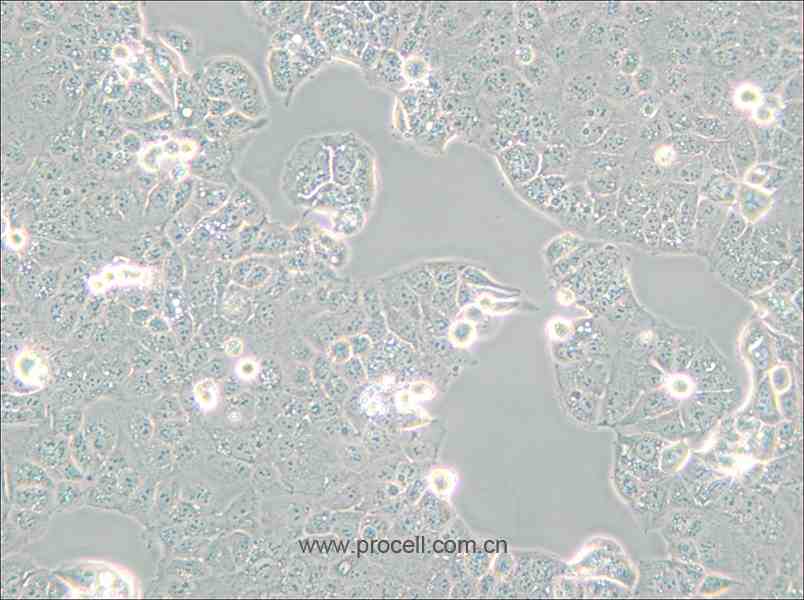 HEC-1-A (人子宮內膜腺癌細胞) (STR鑒定正確)