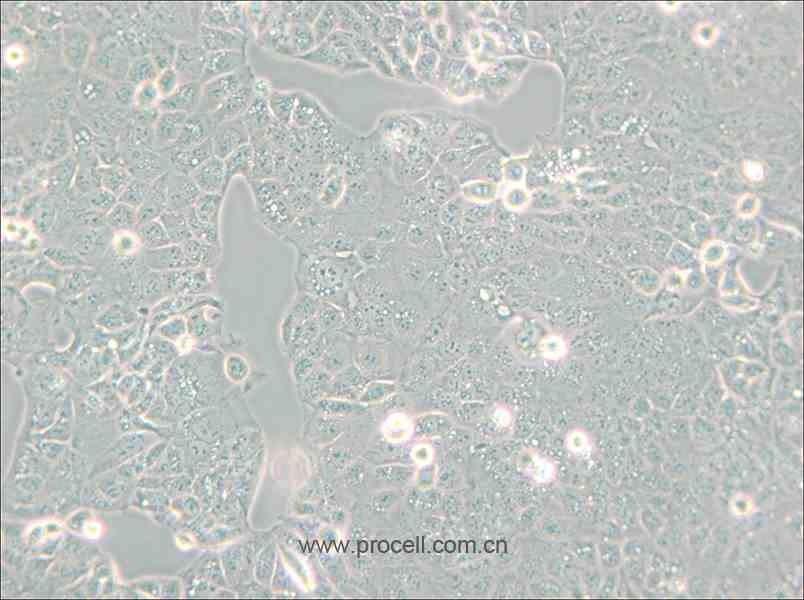 HEC-1-A (人子宮內膜腺癌細胞) (STR鑒定正確)