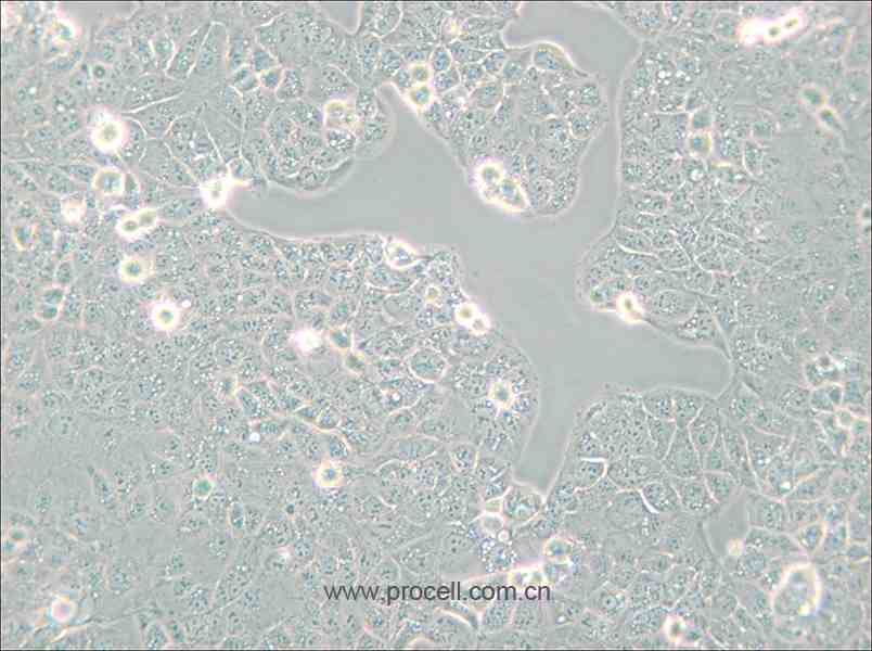 HEC-1-A (人子宮內膜腺癌細胞) (STR鑒定正確)