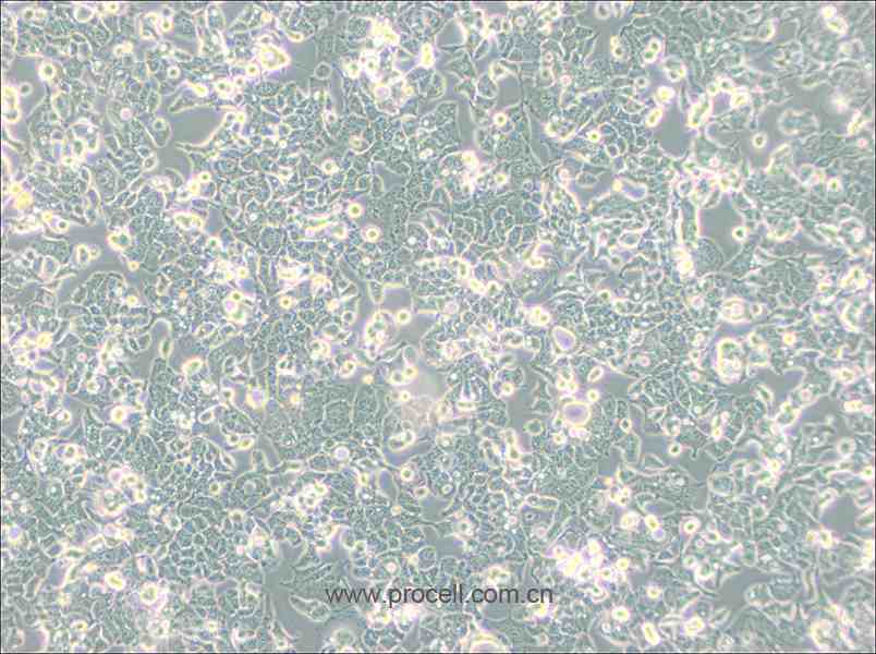 HEC-1-B (人子宮內(nèi)膜腺癌細(xì)胞) (STR鑒定正確)