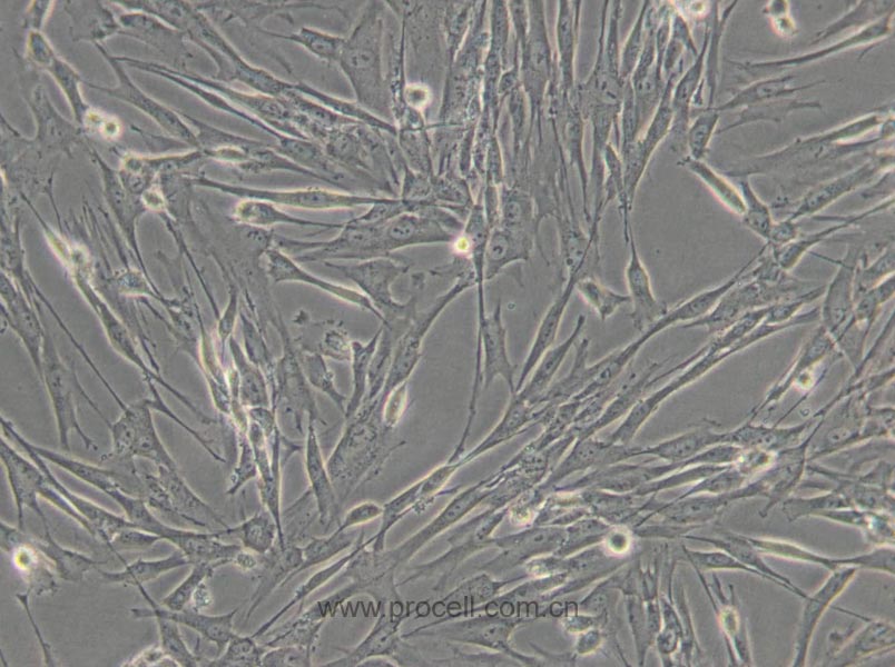 HFL1 (人胚肺成纖維細(xì)胞) (STR鑒定正確)