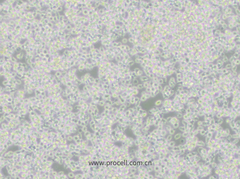 HMy2.CIR (人B淋巴母細(xì)胞) (STR鑒定正確)