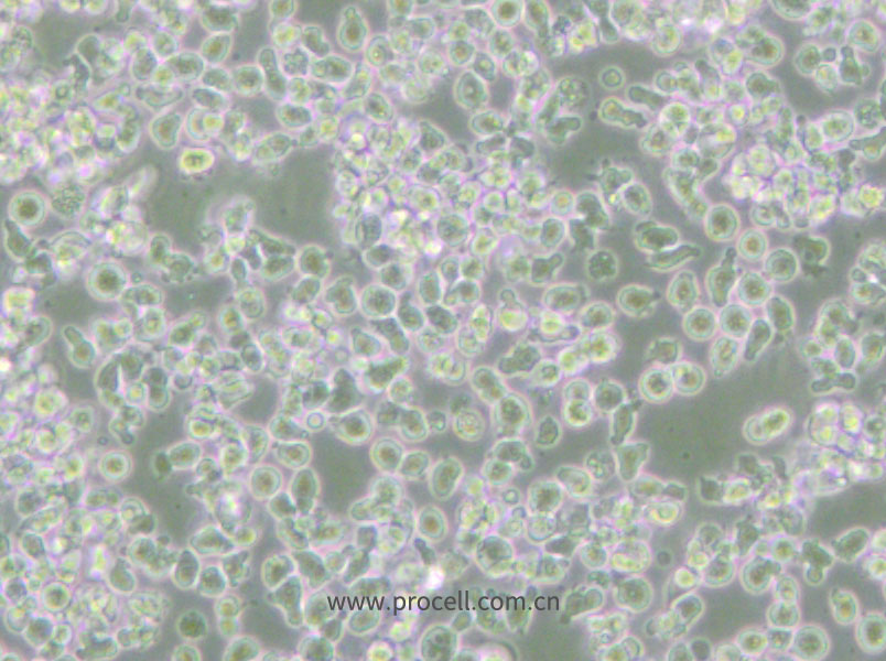 HMy2.CIR (人B淋巴母細(xì)胞) (STR鑒定正確)