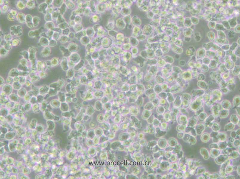 HMy2.CIR (人B淋巴母細(xì)胞) (STR鑒定正確)