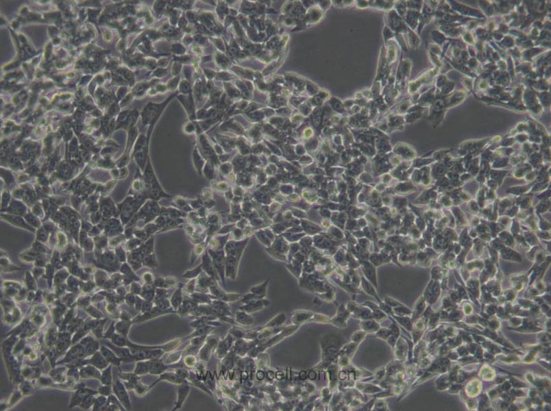 HSC-T6 (大鼠肝星形細(xì)胞) (種屬鑒定正確)