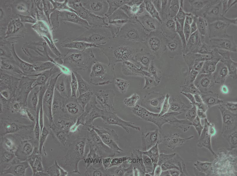 J82 (人膀胱移行細(xì)胞癌) (STR鑒定正確)