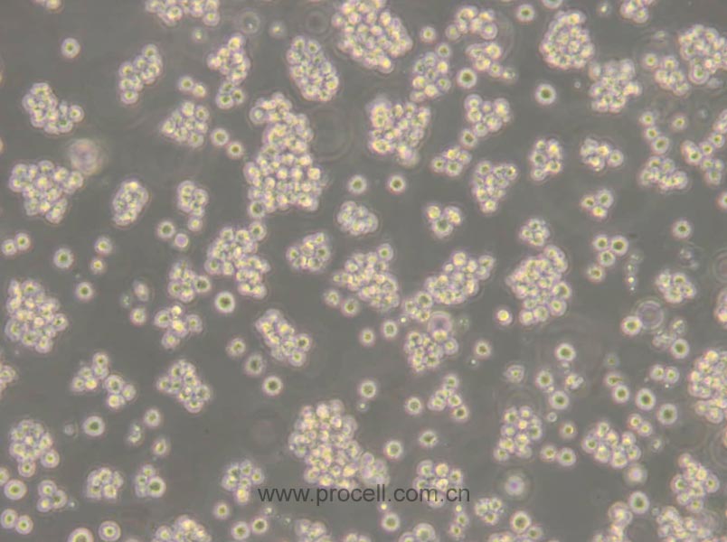 Jurkat, Clone E6-1 (人T淋巴細胞白血病細胞) (STR鑒定正確)