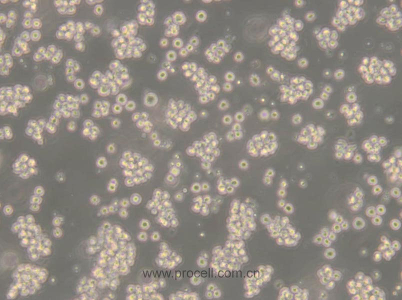 Jurkat, Clone E6-1 (人T淋巴細胞白血病細胞) (STR鑒定正確)