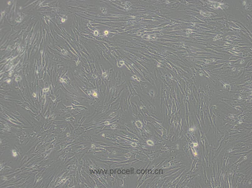 MRC-5 (人胚肺細胞) (STR鑒定正確)