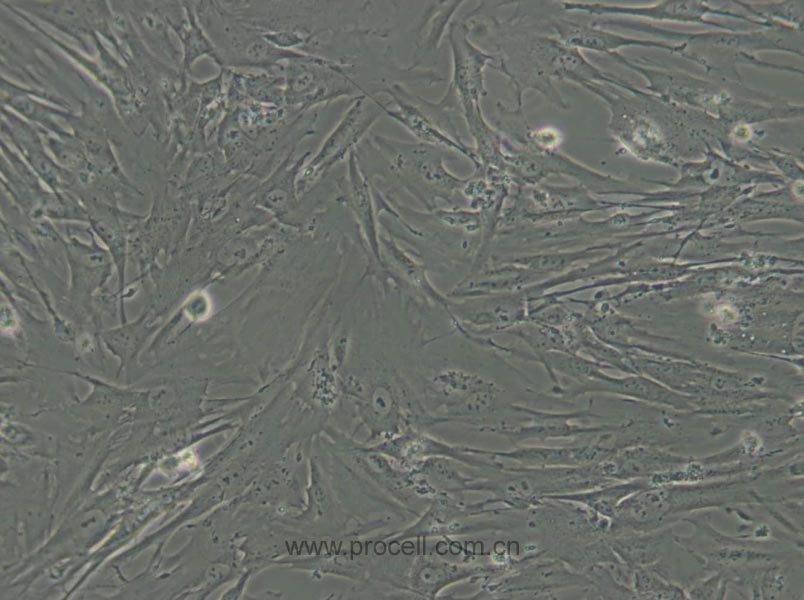 MRC-5 (人胚肺細(xì)胞) (STR鑒定正確)