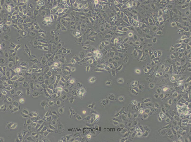 NCI-H292 (人肺癌細(xì)胞(淋巴結(jié)轉(zhuǎn)移)) (STR鑒定正確)