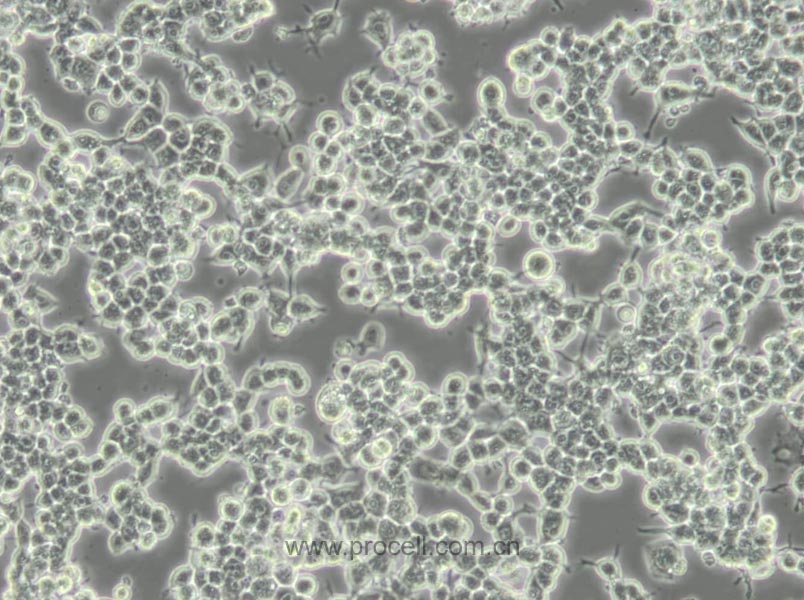 Neuro-2a [N2a; Neuro-2a] (小鼠腦神經(jīng)瘤細(xì)胞) (STR鑒定正確)