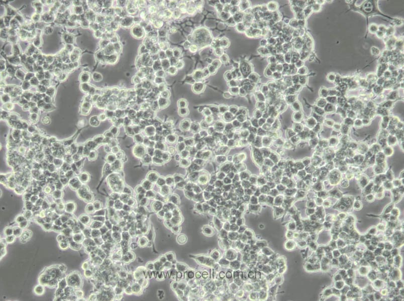 Neuro-2a [N2a; Neuro-2a] (小鼠腦神經(jīng)瘤細(xì)胞) (STR鑒定正確)