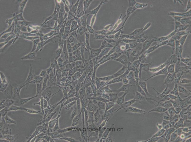 NIH/3T3 (小鼠胚胎細(xì)胞) (STR鑒定正確)