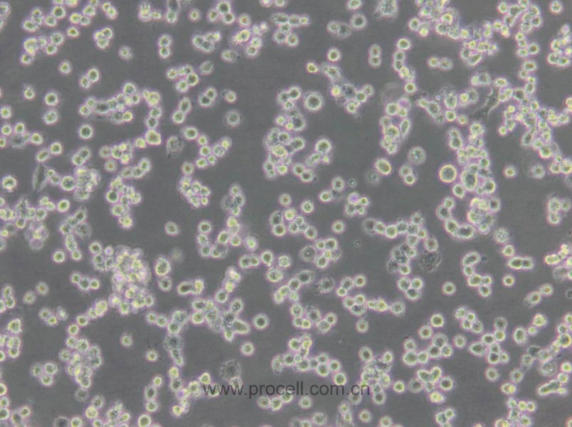 NR8383 [AgC11x3A; NR8383.1] (大鼠肺泡巨噬細(xì)胞) (種屬鑒定正確)