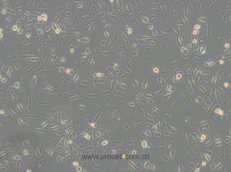 OS-RC-2 (人腎癌細(xì)胞) (STR鑒定正確)