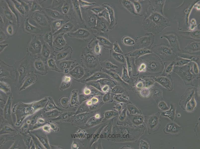 OS-RC-2 (人腎癌細(xì)胞) (STR鑒定正確)