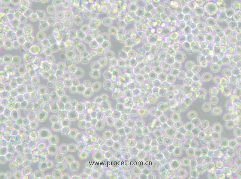 P3X63Ag8 (小鼠骨髓瘤細(xì)胞) (種屬鑒定正確)