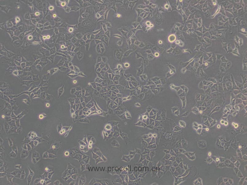 PANC-1 (人胰腺癌細(xì)胞) (STR鑒定正確)