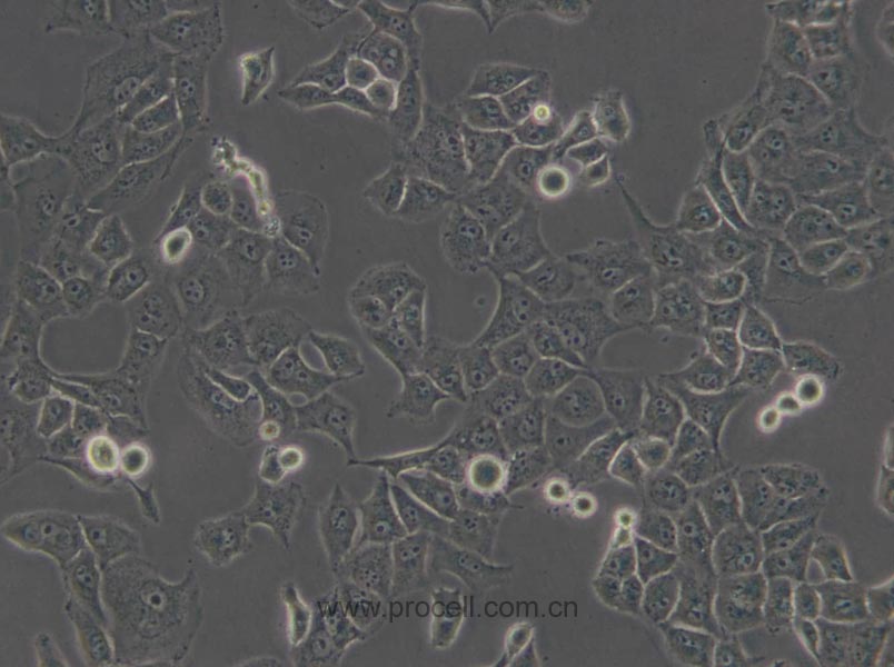 PANC-1 (人胰腺癌細(xì)胞) (STR鑒定正確)