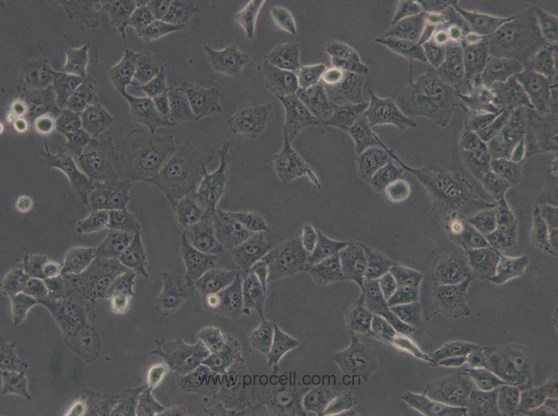 PANC-1 (人胰腺癌細(xì)胞) (STR鑒定正確)