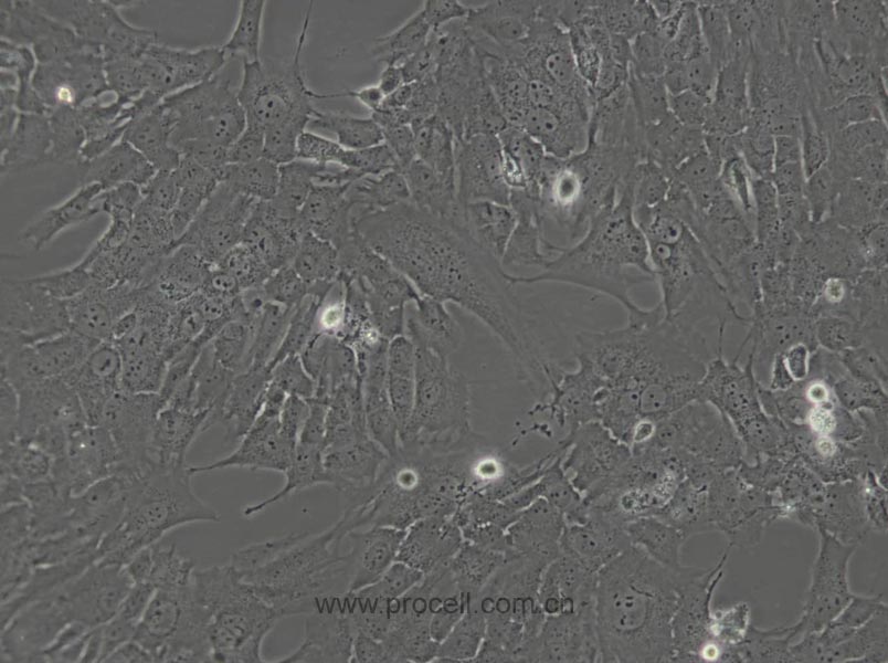 RF/6A (猴脈絡(luò)膜-視網(wǎng)膜內(nèi)皮細(xì)胞) (種屬鑒定正確)