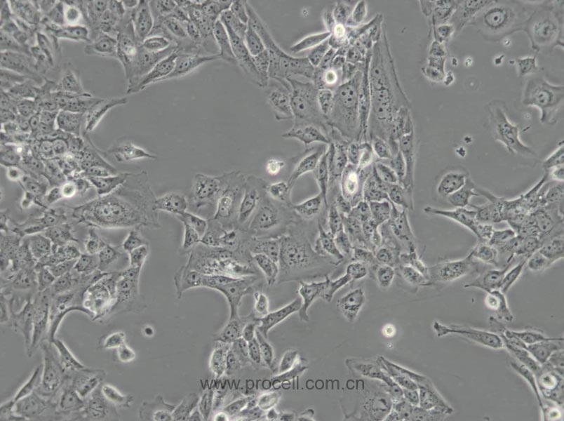 SV-HUC-1 (人輸尿管上皮永生化細(xì)胞) (STR鑒定正確)