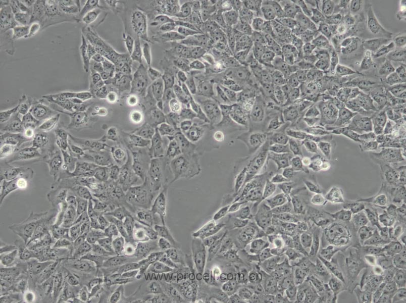 SV-HUC-1 (人輸尿管上皮永生化細(xì)胞) (STR鑒定正確)