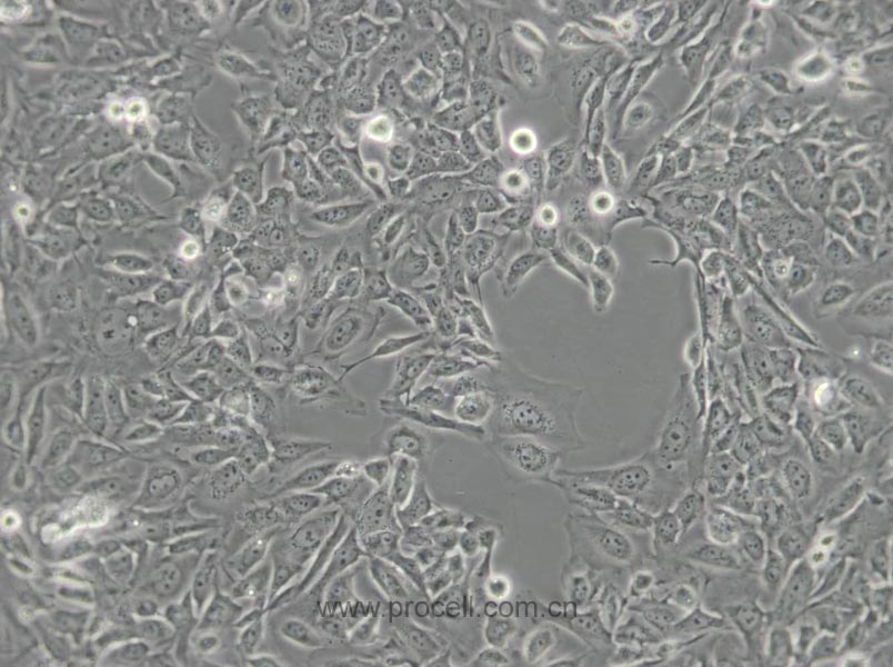 SV-HUC-1 (人輸尿管上皮永生化細(xì)胞) (STR鑒定正確)